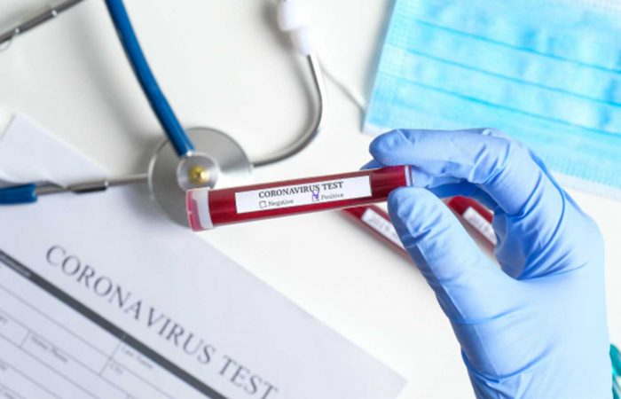 Help in the fight with Coronavirus